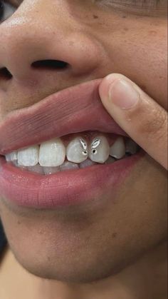 tooth jewel, butterfly diamond tooth gem Diamond Tooth Gem, Teeth Gens, Tooth Gem Ideas, Crest Whitening Strips, Tooth Jewel, Teeth With Braces, Smile Aesthetic, Teeth Gems, Teeth Aesthetic