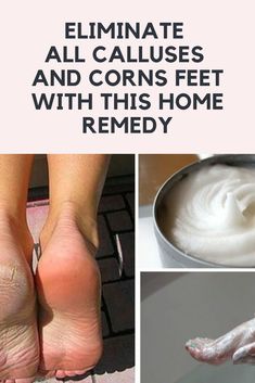 Get Rid Of Corns, Vicks Vaporub Uses, Pedicure At Home, Health Dinner Recipes, Foot Health, The Glory