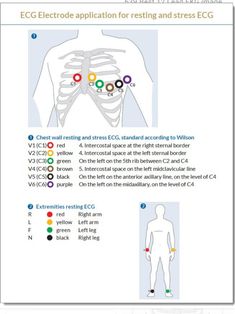 Easy Ekg Interpretation Cheat Sheets, Ekg Basics Nursing, Emt Notes, Ecg Placement, 12 Lead Ekg Interpretation Made Easy, Emt Study, Medical Terminology Study, Ecg Interpretation, Nursing Study Tips