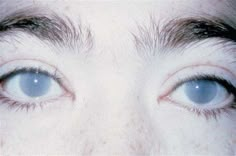 the eyes of a man with blue eyes are shown in this image, and there is only one eye visible