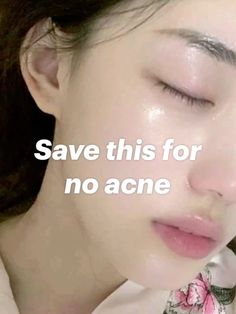 What Helps Acne, Save This Pin For Clear Skin, How To Get Clear Skin Quickly, How To Help Acne, Acne Skin Aesthetic, No Acne Clear Skin, How To Get Rid Of Chin Acne, Ways To Get Rid Of Acne, Pretty With Acne