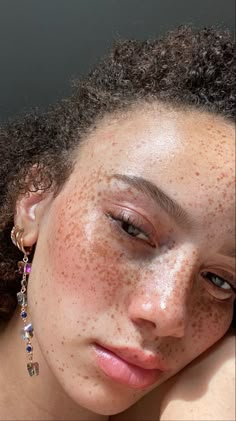 Full Face Freckles, Freckles All Over Face, Glass Skin Freckles, Glass Skin With Freckles, Clear Skin With Freckles Aethstetic, Beauty Marks Aesthetic, Bare Face Aesthetic, Freckles On Face, Body Freckles