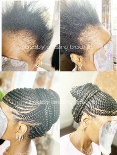 Braids That Cover Bald Edges, Braids For Thinning Edges, Braids To Hide Bald Edges, Alopecia Braid Styles, Braids Styling, Natural Braided Hairstyles, Ghana Braids