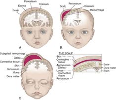 the head and neck are labeled in three different sections, including the top part of the brain