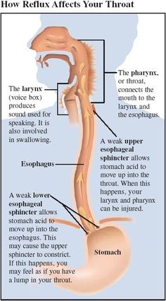 the diagram shows how reflexs affects your throat