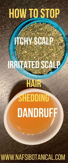 Natural Hair Scalp Care, Scaly Scalp Remedies, Oily Scalp Remedy Diy, Hair Mask For Itchy Scalp Diy, Herbs For Dandruff, Extreme Dandruff Remedies, Dry Scalp Hair Mask Diy, Herbs For Dry Scalp, Natural Remedies For Dandruff Dry Scalp