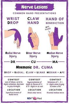 Neuro Occupational Therapy, Physical Therapy Student Study, Pt School, Studie Hacks, Radial Nerve, Median Nerve