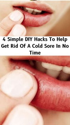 Natural Decongestant Quick Cold Sore Remedy, Cold Sore Remedy Overnight How To Get Rid, Cold Sores Remedies Overnight, How To Get Rid Of A Cold Sore Fast, How To Get Rid Of Cold Sores, Canker Sore Remedy Overnight, How To Get Rid Of Cold Sores Overnight