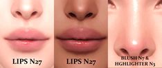 lip fillers for lips and nose shapes