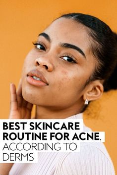 Several misconceptions and myths about skincare routines for acne-prone skin have risen out people trying to get rid of pimples fast.#acne #skincare #skincareroutine Pimple Solution, Get Rid Of Pimples, Rid Of Pimples, How To Reduce Pimples, Treating Hyperpigmentation, Pimples Overnight, Wrinkle Free Skin