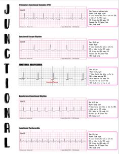 Paramedic Notes, Telemetry Technician, Paramedic Study, Diagnostic Medical Sonography Student, Nursing Hacks, Medications Nursing, Nurse Brain, Sonography Student, Health Notes