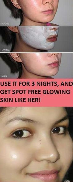 Use it for 3 Nights, and get Spot free glowing skin Like Her Membentuk Alis, Face Beauty, Exercise Tips, Remove Dark Spots, Beauty Remedies, Skin Remedies, Natural Face, Skin Tips, Flawless Skin