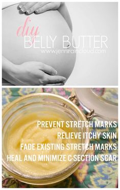 Diy Belly Butter, Relieve Itchy Skin, Belly Oil, Acne Prone Skin Care, Lotion For Oily Skin, Top Anti Aging Products, Tips For Oily Skin, Oily Skin Acne, Anti Wrinkle Skin Care