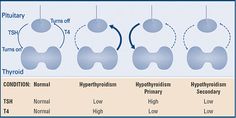 Thyroid tests - how the thyroid works article Low Tsh, Thyroid Ultrasound, Nurse Things, Thyroid Test, Thyroid Symptoms, Graves Disease, Thyroid Issues, Thyroid Function, Thyroid Gland