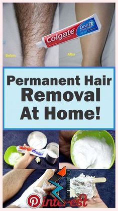 Permanent Hair Removal At Home, Brazilian Hair Removal, Permanent Hair Removal Cream, Upper Lip Hair Removal, Hair Removal At Home, Lip Hair Removal, Hair Remove