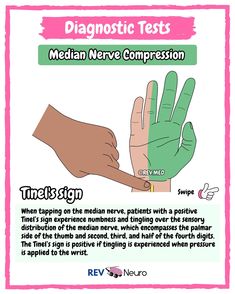 a poster with instructions on how to use the hand signals for medical purposes, including