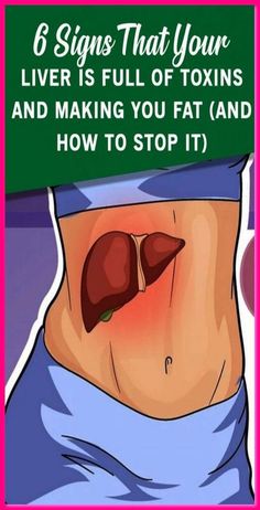 6 CLEAR WARNING SIGNS YOUR LIVER IS FULL OF TOXINS AND MAKING YOU FAT (HOW TO STOP IT) Liver Damage, Sleep Remedies, Women Health, The Liver, Body Anatomy, Liver Health, Natural Sleep