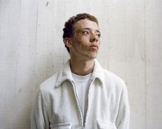 a man with freckled hair wearing a white jacket