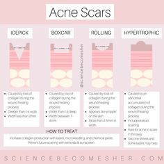 Back Acne Remedies, Acne Scaring, Blind Pimple, Pimples Under The Skin, Bad Acne, Acne Scar, Types Of Acne