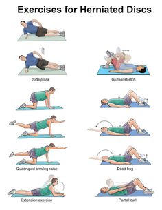 an exercise poster showing how to do back pain exercises