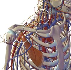 Understanding Thoracic Outlet Syndrome - Anatomy & Physiotherapy Thoracic Outlet, Breast Implant Illness, Sports Therapy, Shoulder Massage, Sports Massage, Hand Therapy, Thai Massage, Massage Room