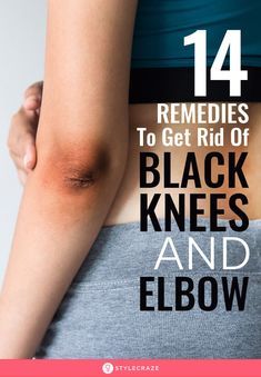 Dark Elbows And Knees, Dark Knees And Elbows, Skin Lightening Diy, Dark Knees, Dark Elbows, Skin Care Home Remedies, Natural Skin Care Remedies, Tan Removal, Black Skin Care