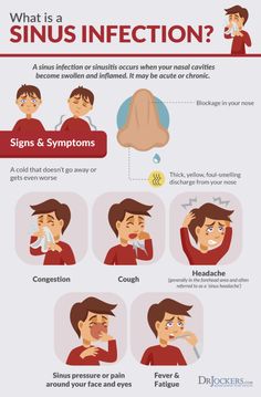 Sinus Headache, Nasal Cavity, Sinus Pressure, Workout Chart, Good Health Tips, Protein Snacks, Health And Fitness Tips