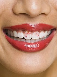 How to Prevent Lipstick From Getting On Your Teeth. How To Keep Lipstick Off Your Teeth, Personal Etiquette, Remedies For Dry Mouth, Common Makeup Mistakes, Applying Lipstick, Best Lipstick Color, Beauty Mistakes, Loose Tooth, Chantal Thomass