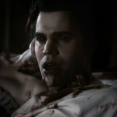 a man with blood on his face and chest laying in bed looking at the camera