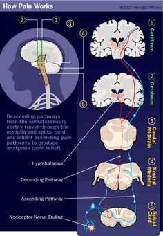 an image of how pain works in the brain