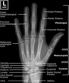 an x - ray shows the bones and their corresponding structures, including carpoidus