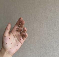 a person's hand with small dots on their fingers and thumbnails in front of a gray wall