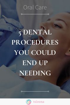 Oral care is often forgotten when it comes to self care but if you don't pay attention to your teeth and your oral hygiene, a trip to the dentist can become more than a simple check-in routine. Here is a list of 5 dental procedures you could end up needing if you don't pay attention to oral health. Severe Tooth Pain, Dental Restoration, Caring Meaning, Dental Cavities, Tooth Pain, Tooth Sensitivity, Stronger Teeth, Hygiene Routine, Dental Procedures