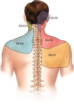 Chronic Back Pain, Forward Head Posture, Spine Health, Cervical Spine, Medical Anatomy, Joints Pain Relief, Body Anatomy, Body Pain