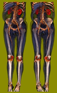 an image of the human skeleton with blood vessels on it's legs and knees