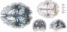 three different views of the human brain, including one with multiple sections and two without