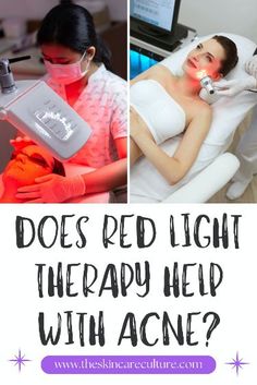 Does Red Light Therapy REALLY Help With Acne? Acne Light Therapy, Acne Prone Skin Care, Light Therapy Mask