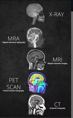 the different types of mris are shown in black and white, including one with an x - ray