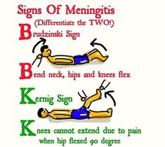 Kernig Sign, Pediatric Neurology, Neuro Nursing, Paramedic School, Nursing Information, Medical Mnemonics, Med Surg Nursing, Brain Surgeon, Nclex Study