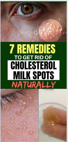 Oatmeal Scrub, Cholesterol Remedies, Health Planner, Health Guide, High Cholesterol, Natural Remedies, Healthy Life, Health Tips