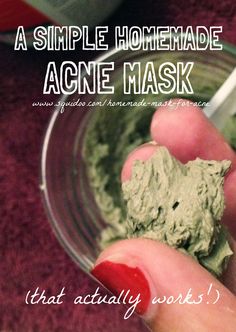 How To Stop Pimples, Homemade Acne Mask, Aztec Clay Mask, Aztec Clay, Mask For Acne, Mask Acne, Acne Mask, Hygiene Tips, Healing Clay