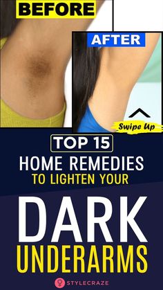 Black Underarms, Underarm Darkness, Fast Baking, Lighten Underarms, How To Whiten Underarms, Vicks Vaporub Uses, Dark Armpits, Skin Care Routine For 20s