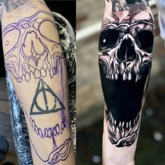 two different tattoos on both arms and legs, one with a skull and the other with a harry potter symbol