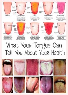 WHAT YOUR TONGUE IS TRYING TO TELL YOU ABOUT YOUR HEALTH Healthy Tongue, Cheezburger Funny, Fortnite Tiktok, Inner Health, Canker Sore, Tongue Health, Aesthetic Inspiration, Photography Aesthetic, Dental Hygiene