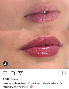 Permanent Makeup Lips, Permanente Make-up, Cosmetic Injectables