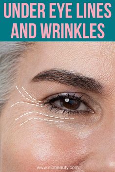 Are lines, creases, and wrinkles forming around your eyes? No need to worry! The beauty experts at SiO reveal how to get rid of eye lines and wrinkles. Under Eye Lines, Home Remedies For Wrinkles, Eye Wrinkles, Wrinkle Remedies, Under Eye Wrinkles, Skin Care Wrinkles, Younger Skin, Glow Skin, Face Wrinkles