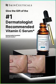 Unlock the Power of C E Ferulic this Holiday Season to Clinically Correct 8 Signs of Aging Aesthetic Skincare Brands, Nose Filler, Ways To Curl Your Hair, C E Ferulic, Tighten Facial Skin, Popular Skin Care Products, Natural Acne, Skincare Brands, Forehead Wrinkles