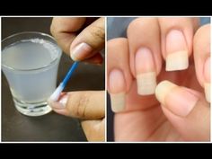 Stronger Nails, Nail Growth, Strong Nails, French Manicure, Lemon Juice, Beauty Nails