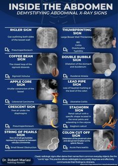 an info sheet describing the different types of medical instruments in each region of the body