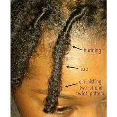 Locs Journey Progress, 2 Months Loc Journey, Budding Stage Locs, 1 Month Starter Locs, 1 Month Locs, Starter Locs Tips, 1 Month Loc Journey, Budding Phase Locs, Locs Budding Stage